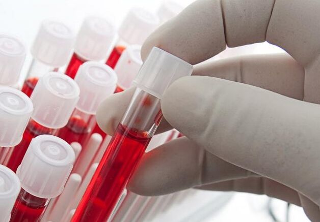 blood analysis after drinking alcohol